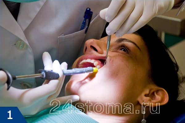 Проведение анестезии перед удалением зуба