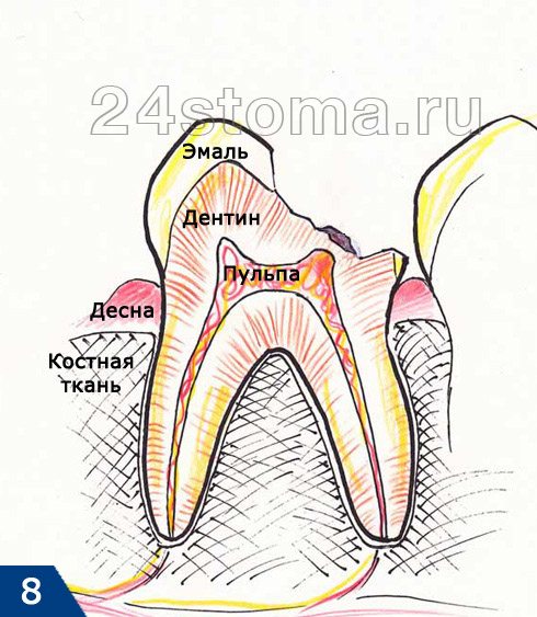 Наложение лечебной прокладки на дно полости зуба