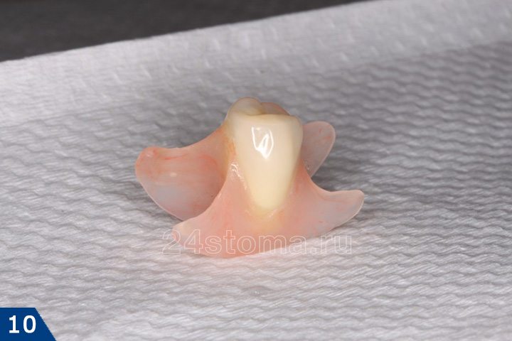 Нейлоновый микро-протез на один зуб