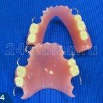 Зубные протезы новое поколение мягких протезов без неба на верхнюю челюсть как их делают
