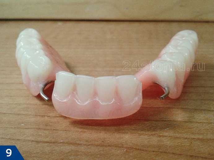 Съемный протез из пластмассы при частичном отсутствии зубов (на нижнюю челюсть)