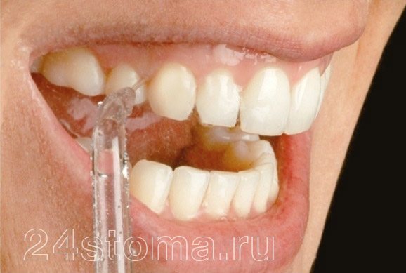 Аппарат для чистки зубов