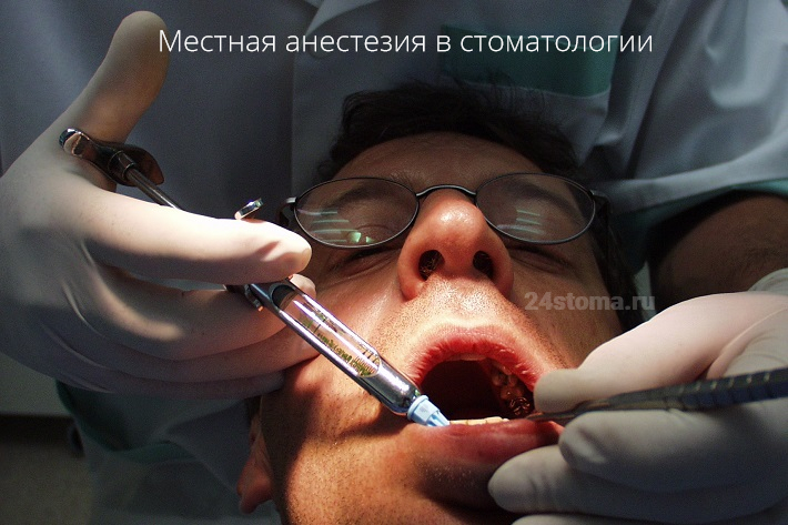 Местная анестезия в стоматологии (обезболивание нижних резцов)