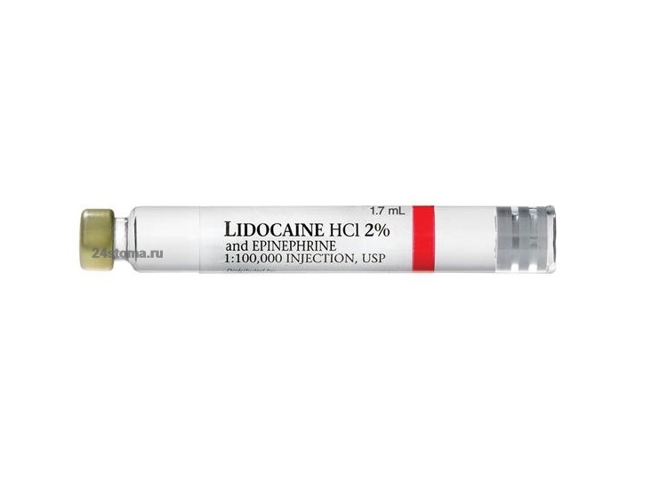 Лидокаин в карпулах (анестетик)