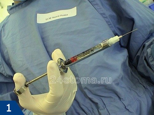 Карпульный шприц для анестезии в руках у стоматолога