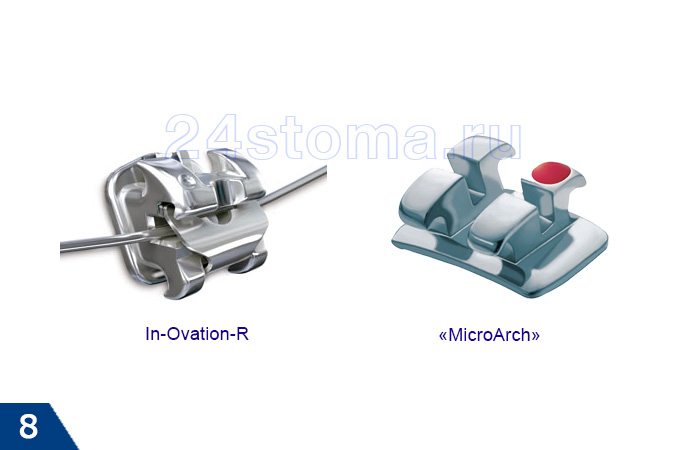 Брекеты «In-Ovation-R», «MicroArch»