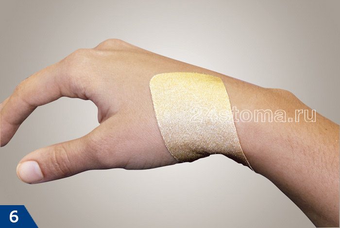 Вид силиконовой повязки на тканевой основе на руке