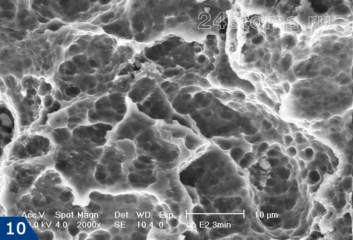 Микропористая поверхность имплантов Альфа Био - «Nano Tec»