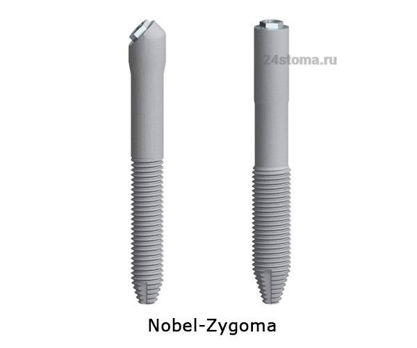 Импланты Nobel-Zygoma