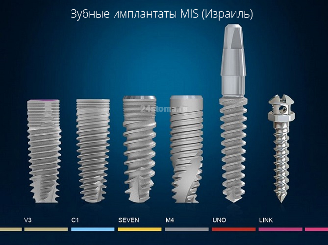Импланты MIS C1 Томск Бирюкова стоматология на ленина в томске