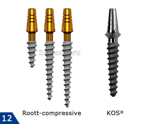 Базальные импланты компрессилнного типа: «Trate AG» (Roott-compressive) и «Ihde Dental AG» (KOS®)