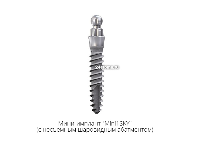 Мини-имплант «Mini1SKY» диаметр 2.8 мм (с несъемным шаровидным абатментом)