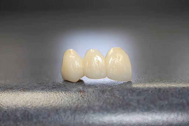 Передние зубы лечение или коронки thumbnail