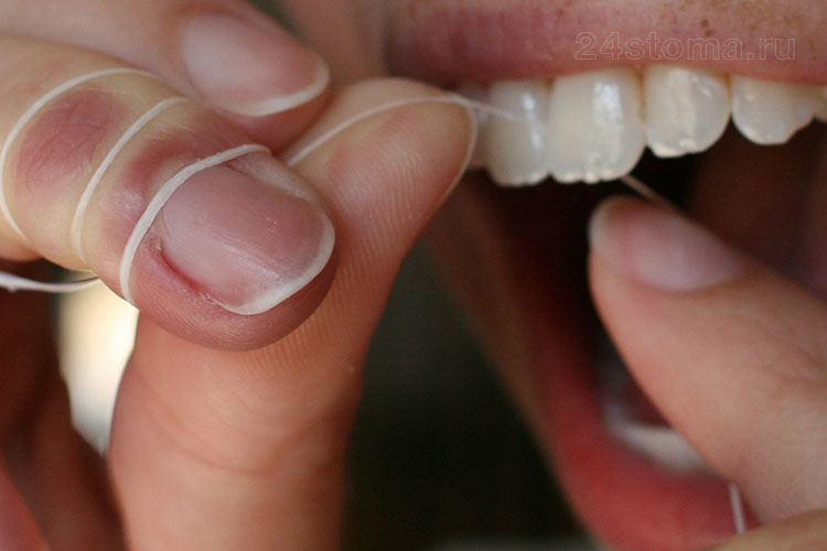 Как чистить зубы зубной нитью