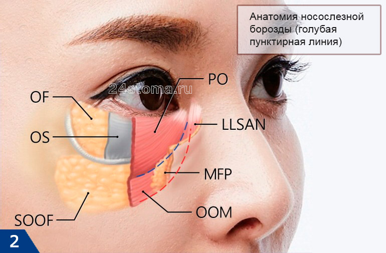 Анатомия носослезной борозды (голубая пунктирная линия)