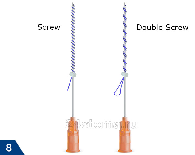 Винтовой тип нитей («Screw» и «Double Screw»)
