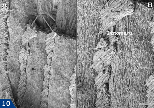 Эмалевые призмы и расположенное между ними межпризматическое вещество (сканирующая электронная микроскопия)