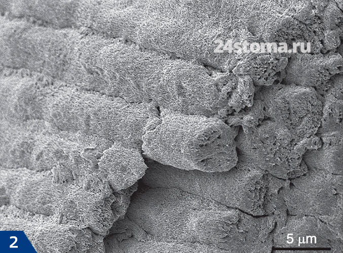 Структурный компонент эмали (эмалевые призмы), сканирующая электронная микроскопия