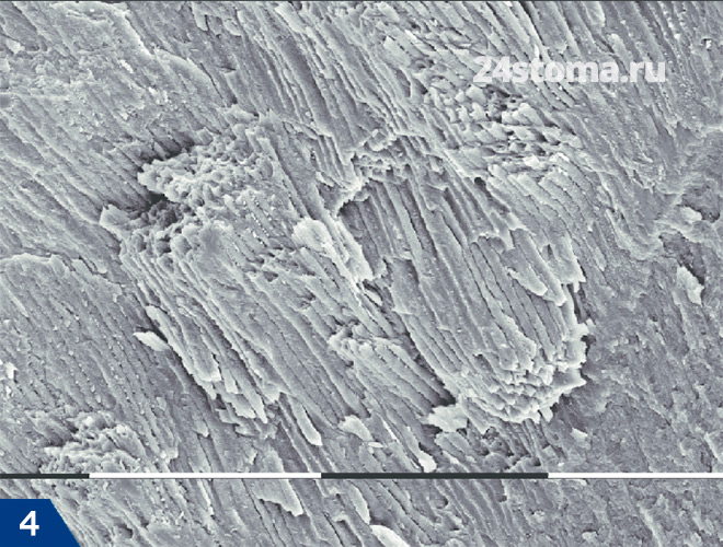 Продольное сечение эмалевых призм (сканирующая электронная микроскопия)
