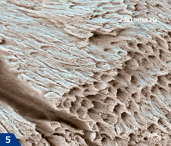 Продольное сечение эмалевых призм (сканирующая электронная микроскопия)