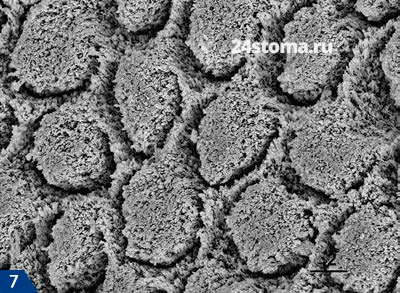 Поперечное сечение эмалевых призм (сканирующая электронная микроскопия)