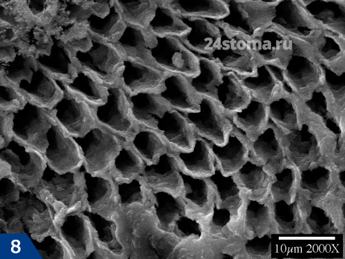 Кора эмалевых призм; эмаль была подвергнута деминерализации в течение 5 дней (сканирующая электронная микроскопия)