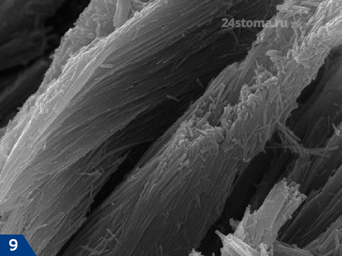 Эмалевые призмы, состоящие из множества кристаллов гидроксиапатита (сканирующая электронная микроскопия)