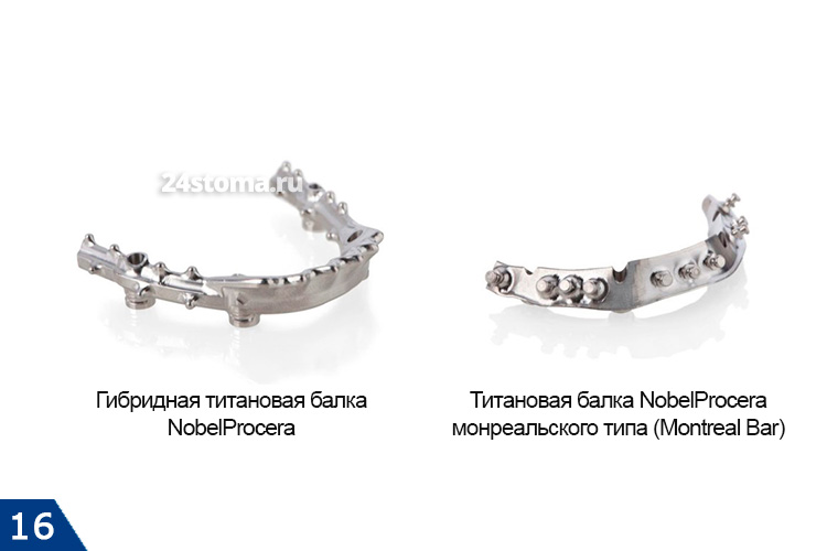 Титановые балки Nobel-Procera (для All-on-4), предназначенные для изготовления титаново-полимерных протезов