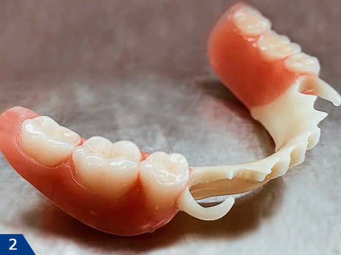 Зубной протез Квадротти на нижнюю челюсть